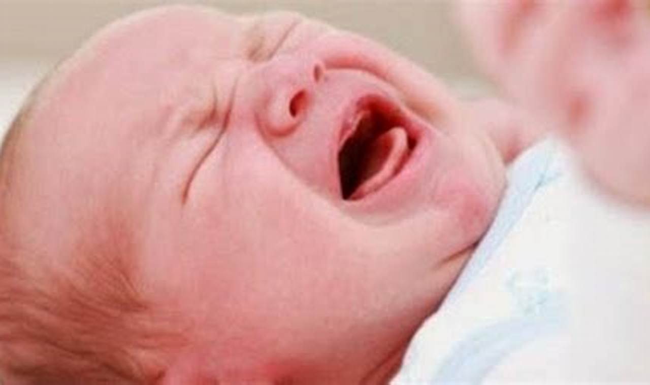 Cara Mengatasi Sariawan Pada Bayi
